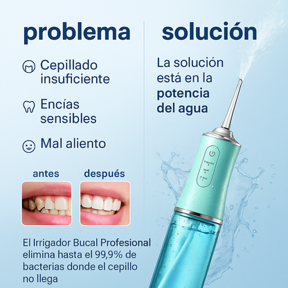 💧 ¡Irrigador Bucal Profesional – Limpieza Dental de Alto Nivel!