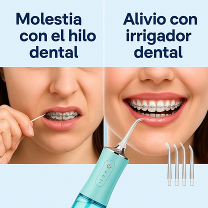 💧 ¡Irrigador Bucal Profesional – Limpieza Dental de Alto Nivel!