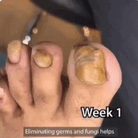 ✨ VitalNails 7D 🌱Reparación Intensiva